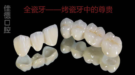 全瓷牙有什么优点？
