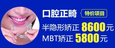 合肥牙齿正畸要花多少钱